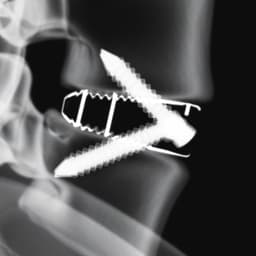 Arcadius XP L®-Product Picture