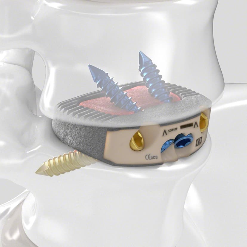 Arcadius XP L®-Product Picture