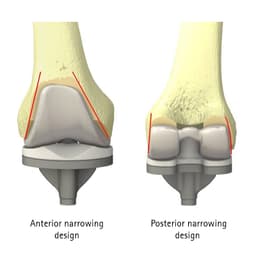 VEGA System®-Product Picture Web Enlargement